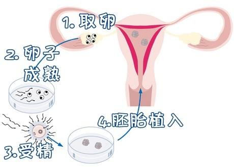 岩墨医疗